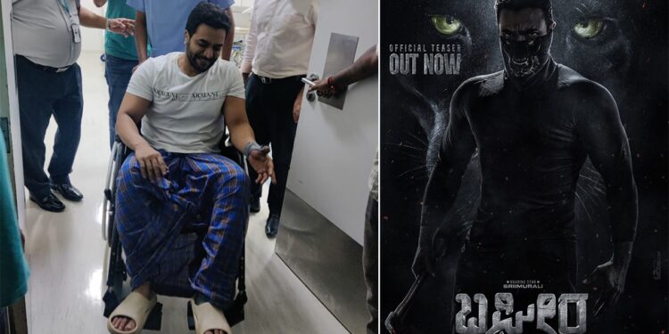Sriimurali: ಚಿತ್ರೀಕರಣದ ವೇಳೆ ನಟ ಶ್ರೀಮುರಳಿ ಕಾಲಿಗೆ ಪೆಟ್ಟು – ಮಣಿಪಾಲ್ ಆಸ್ಪತ್ರೆಯಲ್ಲಿ ಚಿಕಿತ್ಸೆ