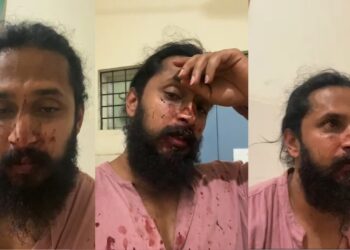 Chethan Chandra: ಕಿರುತೆರೆ ಹಾಗೂ ಸಿನಿಮಾ ನಟನ ಮೇಲೆ ಹಲ್ಲೆ- ರಕ್ತ ಸುರಿಯುತ್ತಿದ್ರು ಲೈವ್‌ ಬಂದು ನ್ಯಾಯ ಬೇಕೆಂದ ನಟ