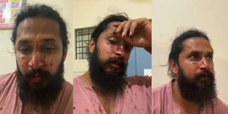 Chethan Chandra: ಕಿರುತೆರೆ ಹಾಗೂ ಸಿನಿಮಾ ನಟನ ಮೇಲೆ ಹಲ್ಲೆ- ರಕ್ತ ಸುರಿಯುತ್ತಿದ್ರು ಲೈವ್‌ ಬಂದು ನ್ಯಾಯ ಬೇಕೆಂದ ನಟ