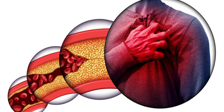 bad cholesterol: ನಿಮ್ಮ ದೇಹದೊಳಗೇ ಇದ್ದಾನೆ ಹೊಂಚಿ ಕೊಲ್ಲುವ ಹಂತಕ!