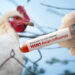 history of bird flu: ಹಕ್ಕಿ ಜ್ವರದ ಬೆನ್ನಟ್ಟಿ ಬರಲಿದೆಯಾ ಭಯಾನಕ ವೈರಸ್?